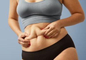 Gordura-Localizada-no-Abdomen